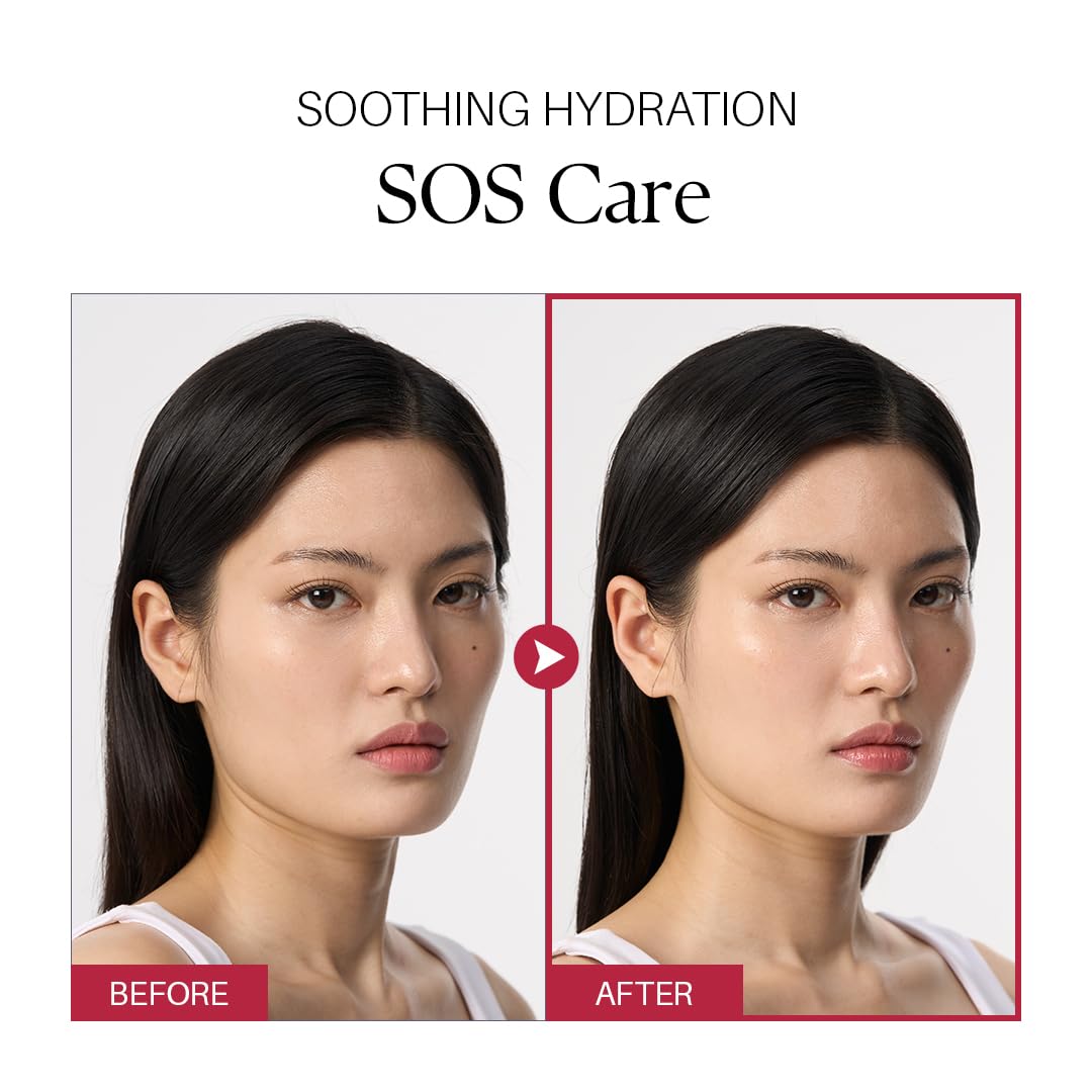 Visage féminin avant/après, peau apaisée et hydratée.