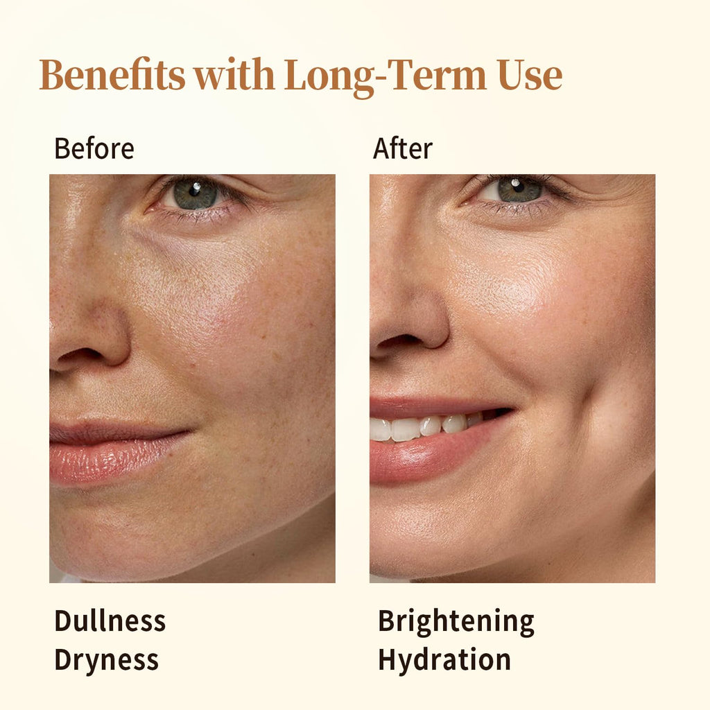 Comparaison visage avant/après : peau plus lumineuse et hydratée