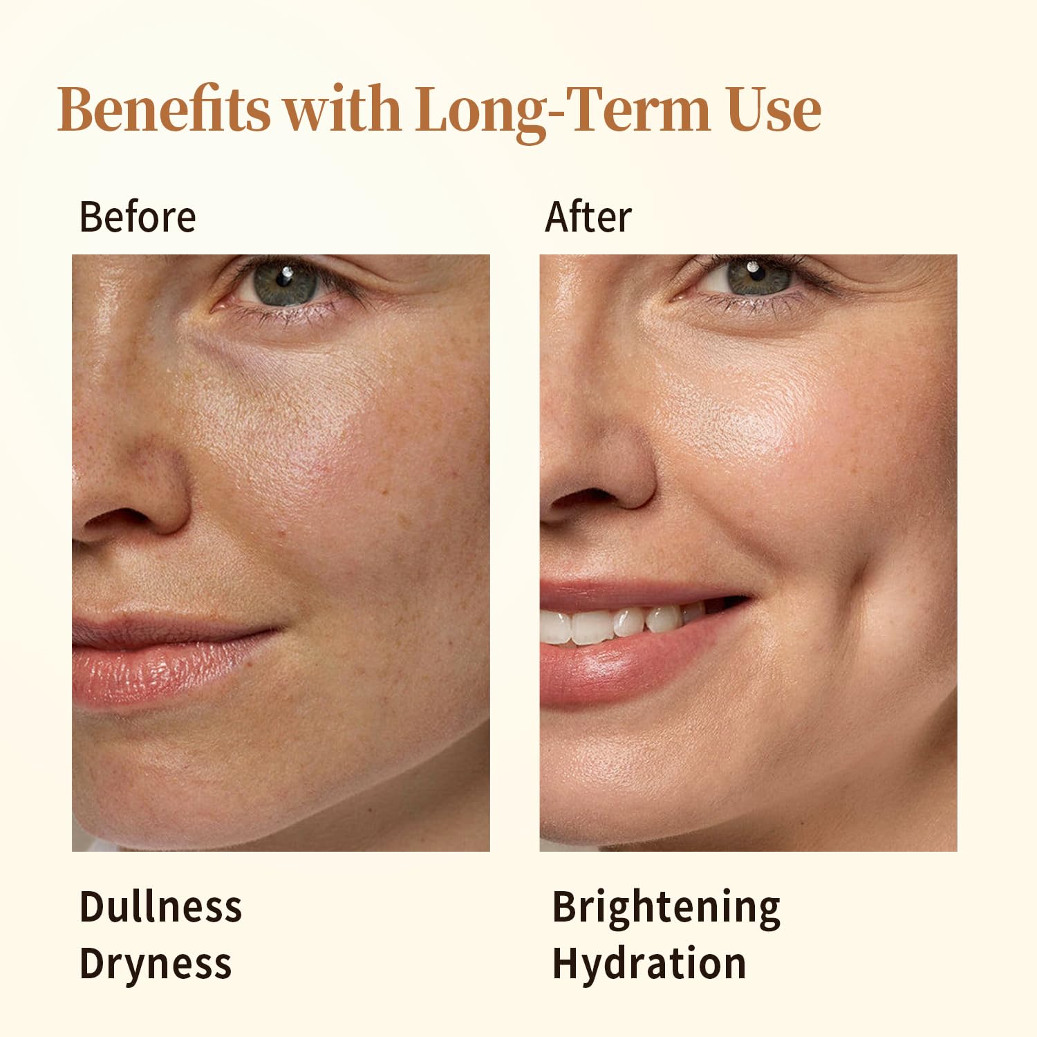 Comparaison visage avant/après : peau plus lumineuse et hydratée